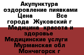 Акупунктура, оздоровление пиявками › Цена ­ 3 000 - Все города, Жуковский г. Медицина, красота и здоровье » Медицинские услуги   . Мурманская обл.,Мончегорск г.